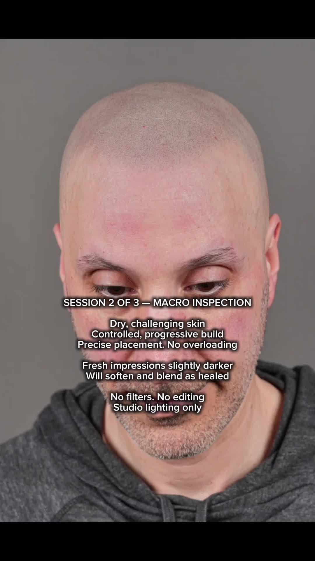 @Enhanced Scalp