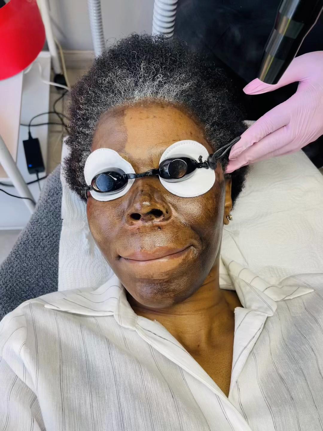 @Zaza beauty laser clinic