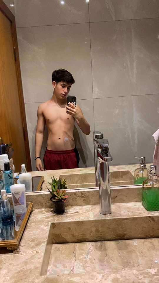 @Feike