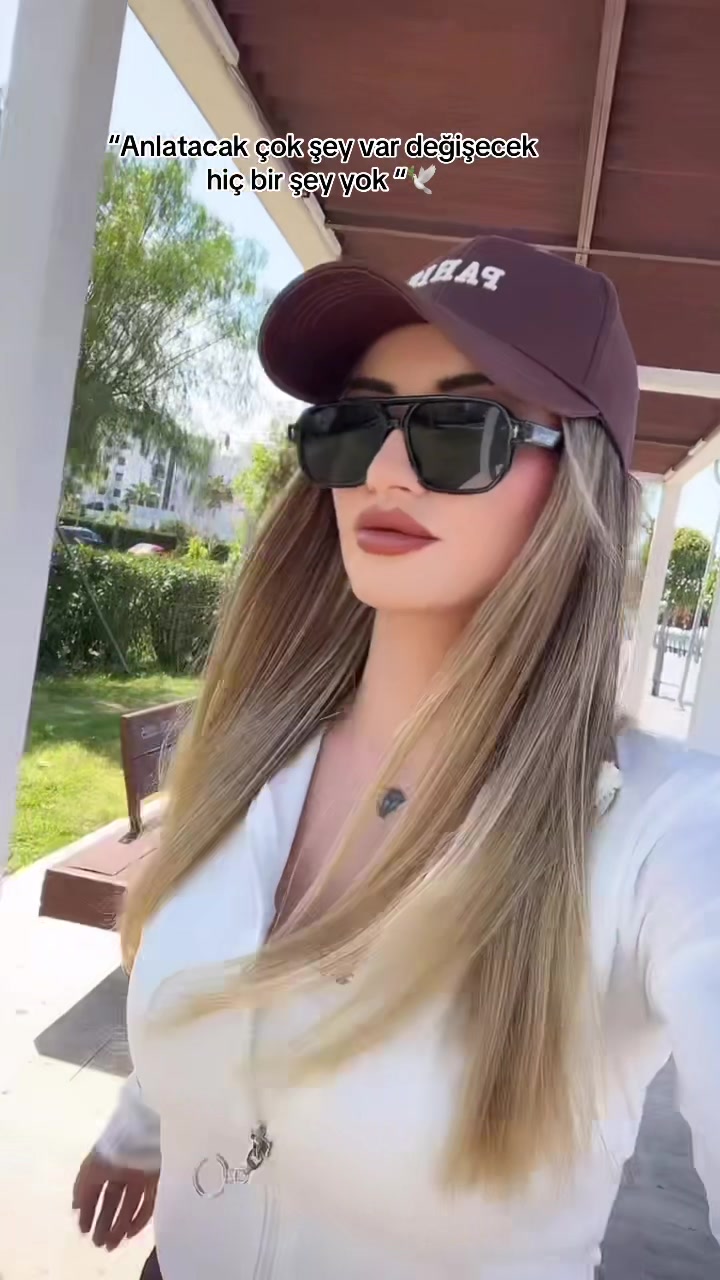 @KİWİ&ensp;GOZLUU