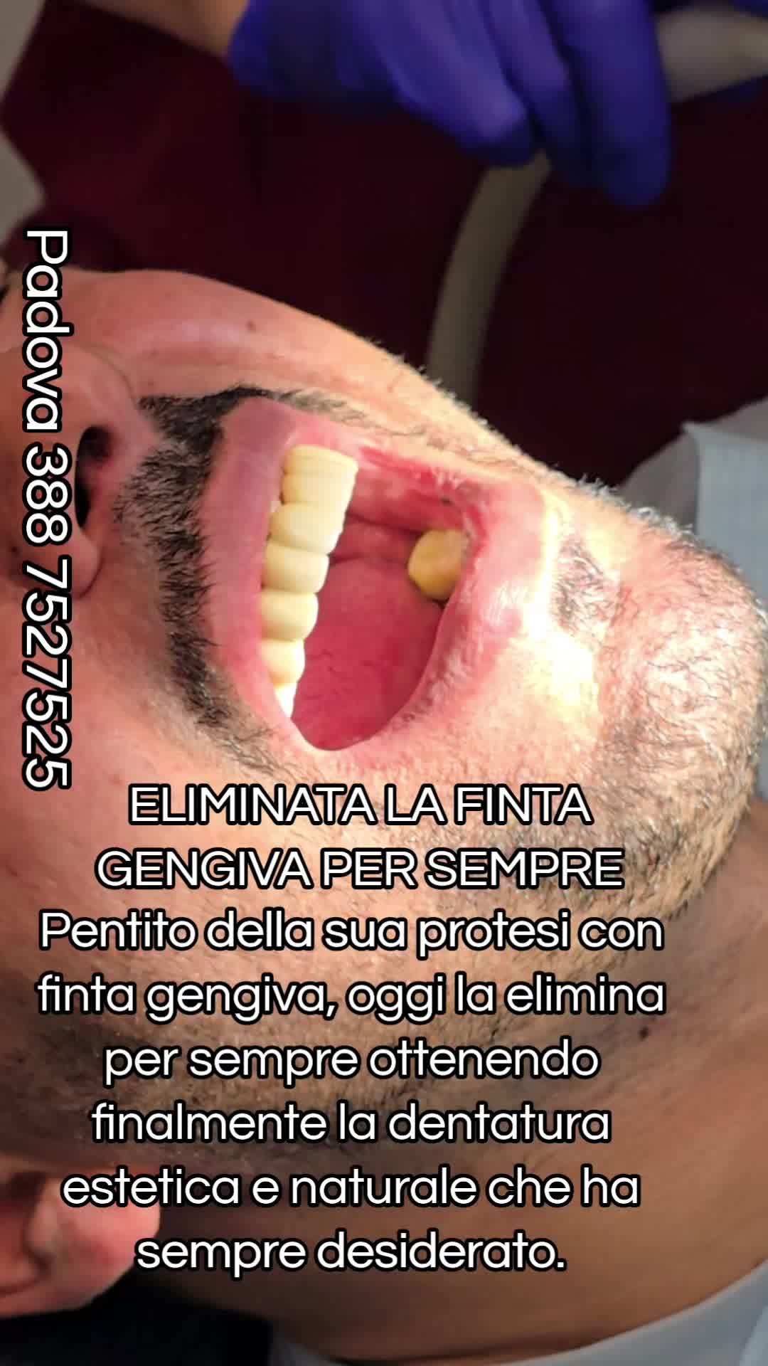 @Implantologiaprezzi