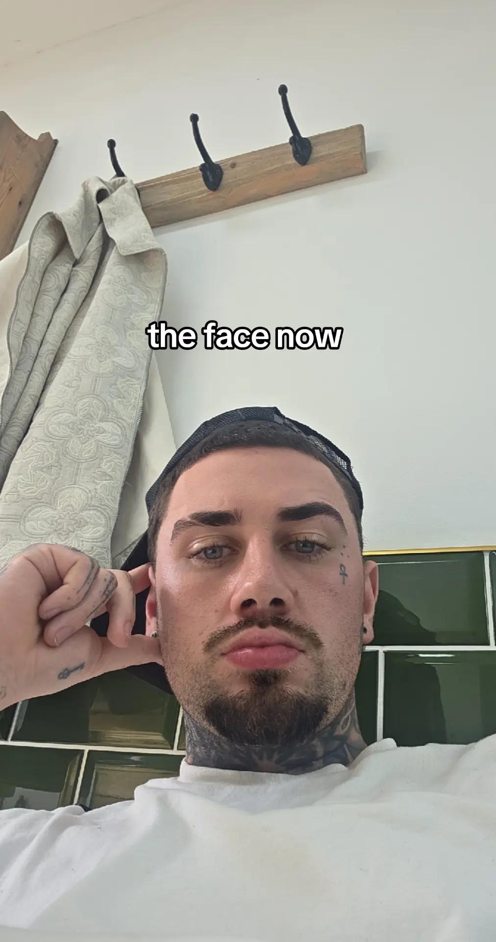 @Aaron