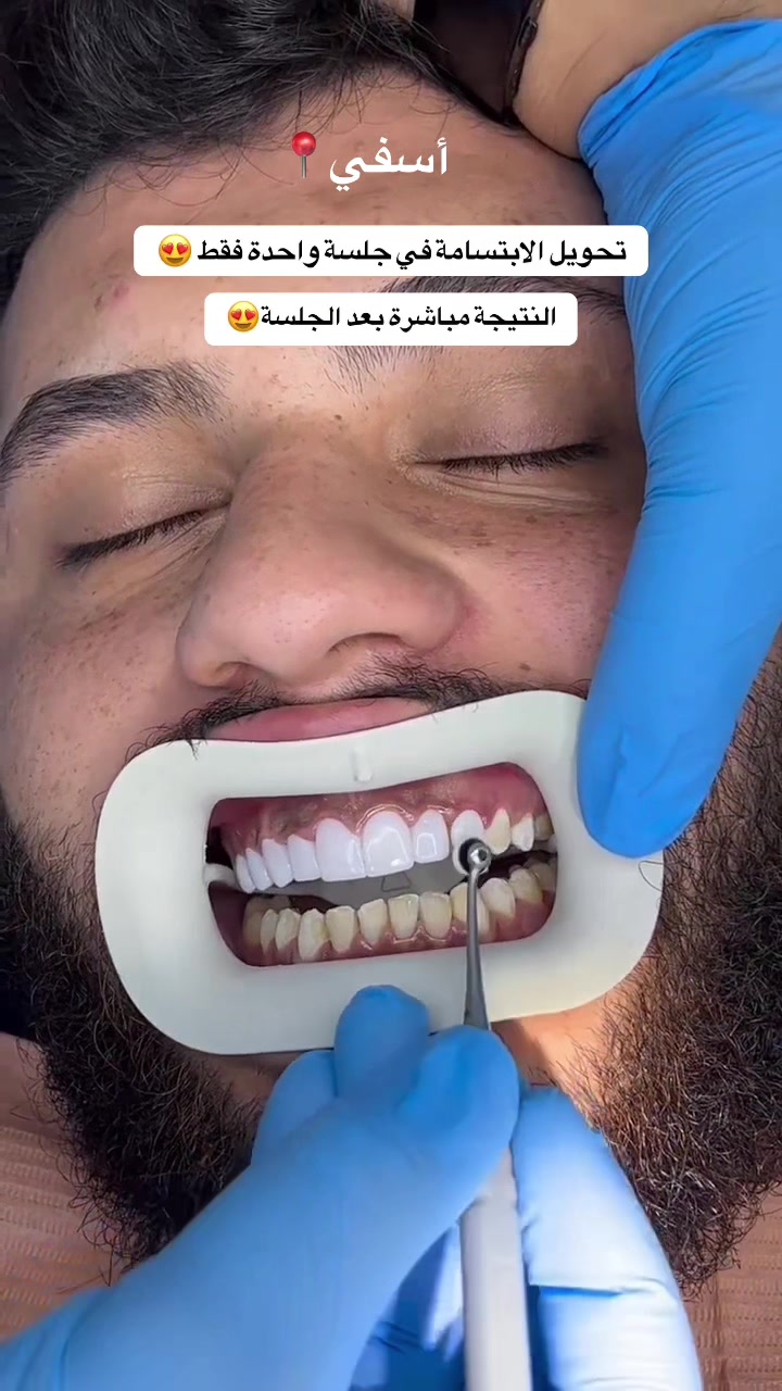 @brightsmileee1