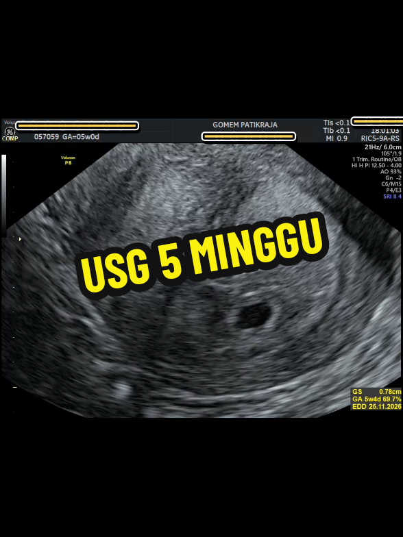 @USG 4D PURWOKERTO