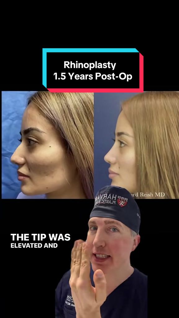 @Dr. Richard Reish, M.D., FACS
