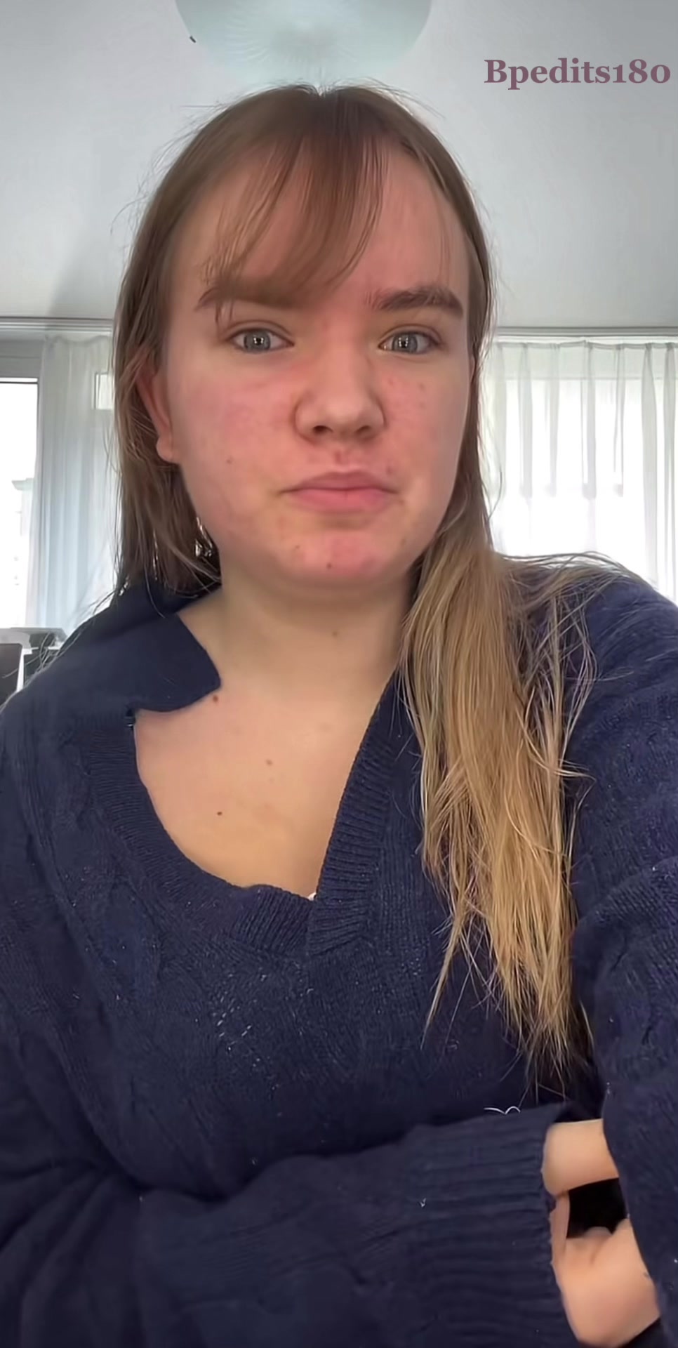 @Bpedits
