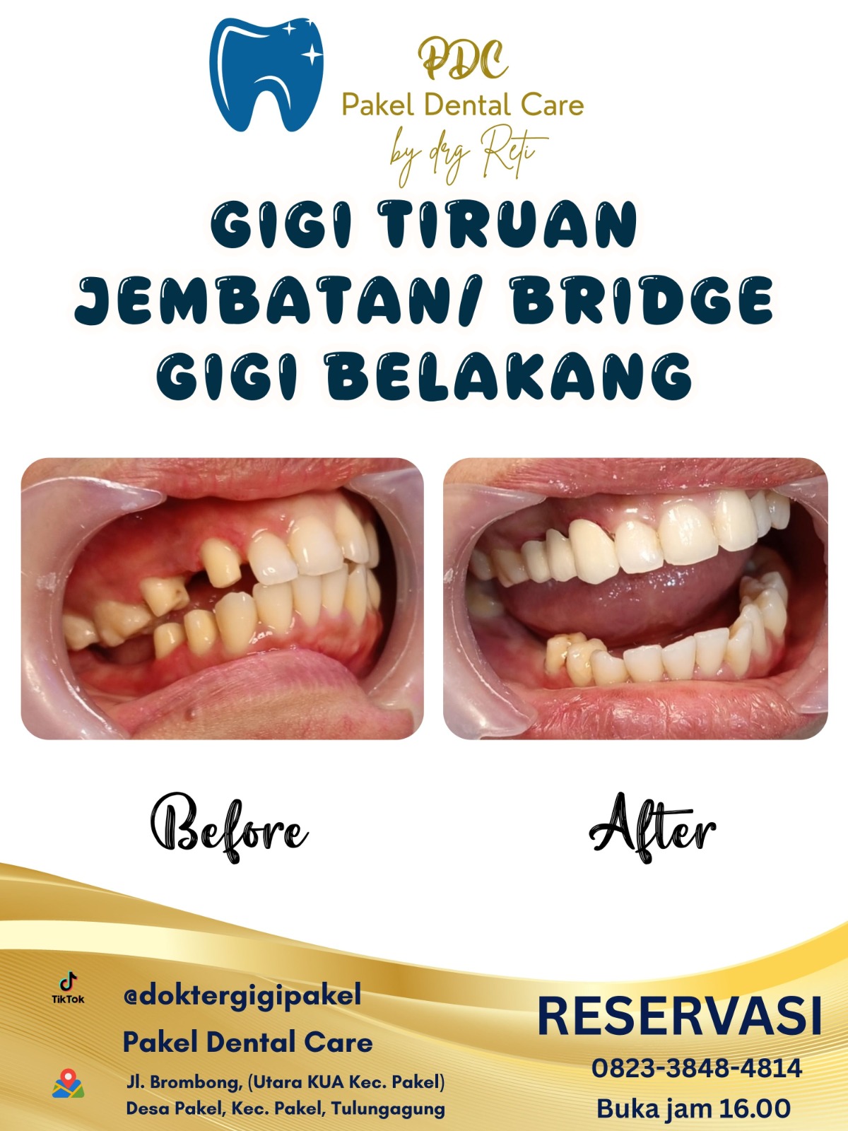 @Pakeldentalcare