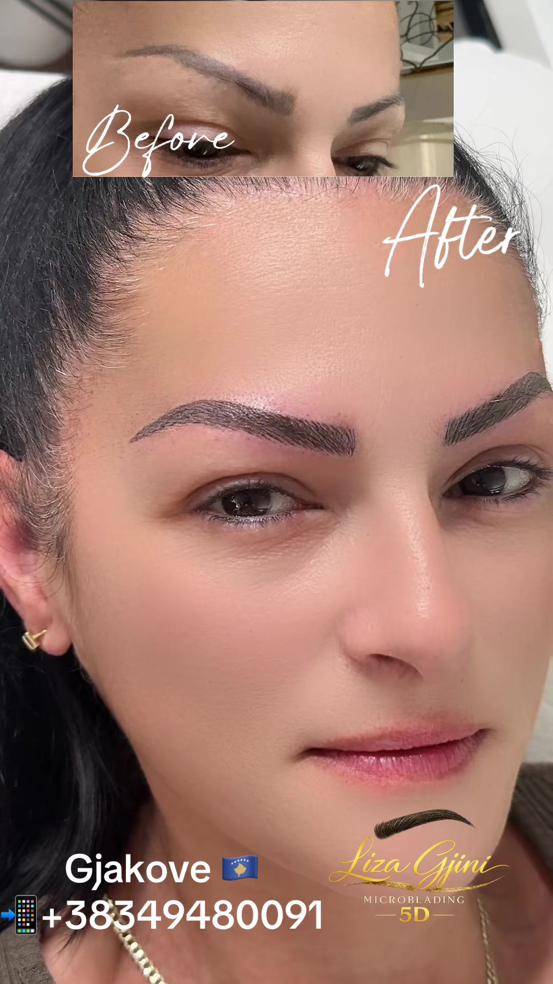 @Liza Gjini Teuta Beauty Center