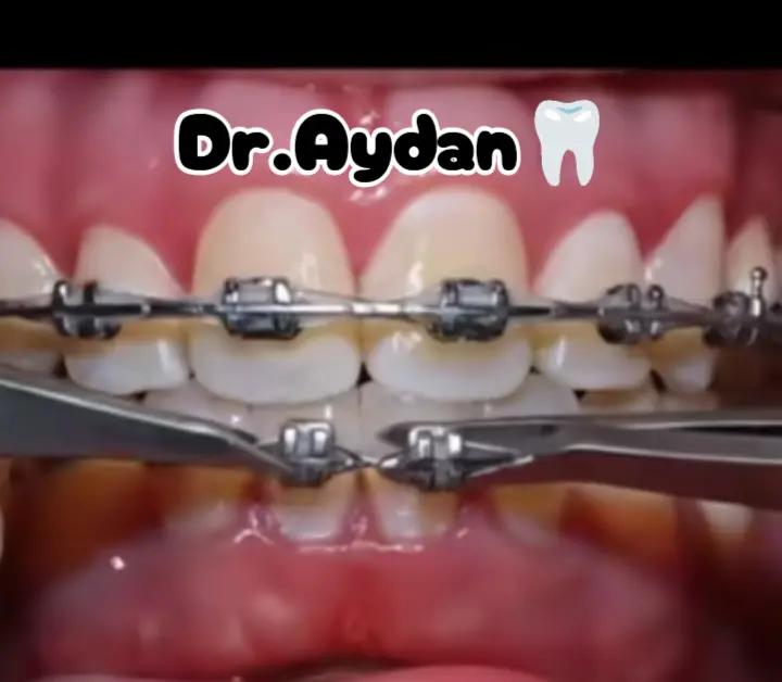 @🦷DR. Mehdizadə Aydan 🦷