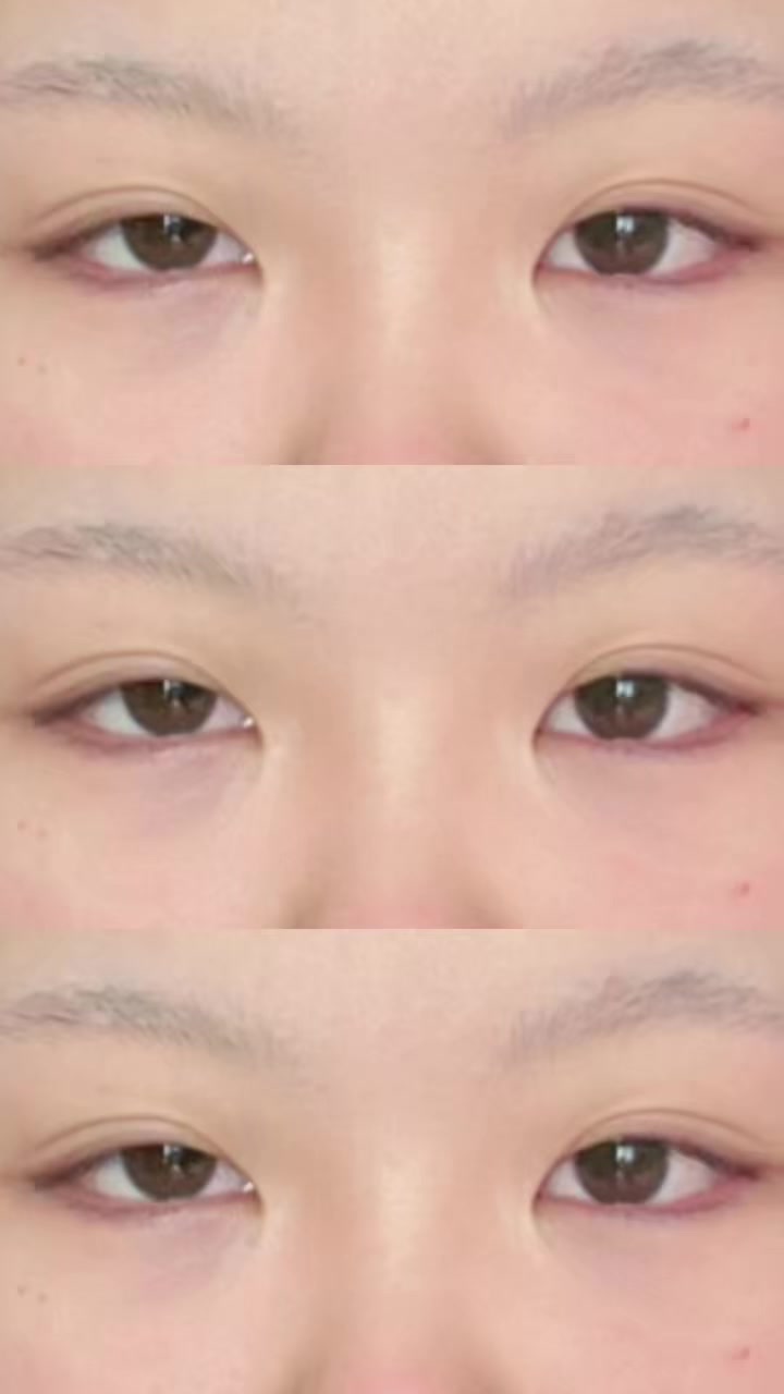 @땅콩