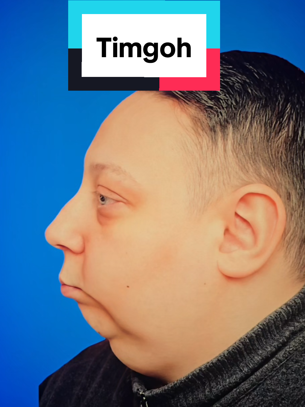 @artcrazy