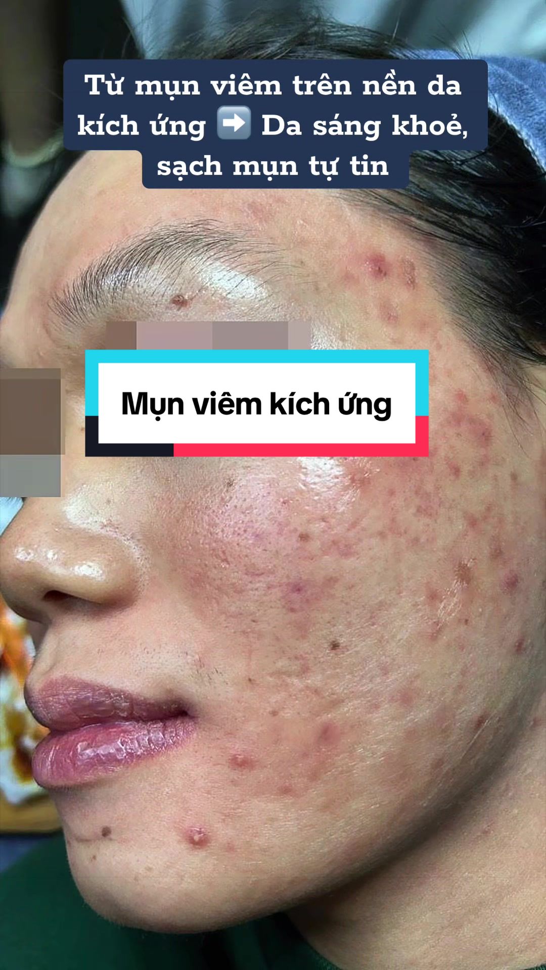 @Ring_Spa