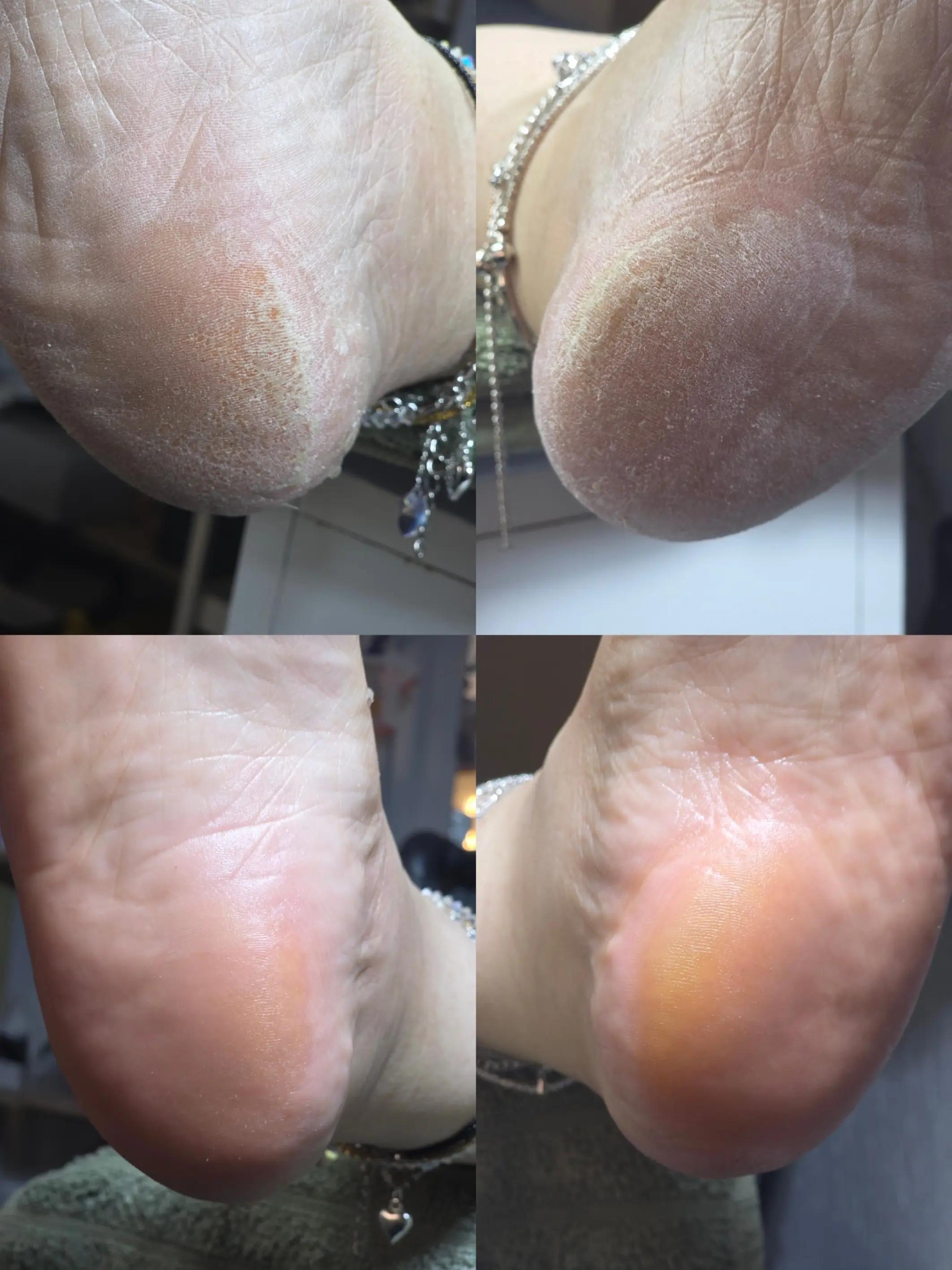 @PurelyNails