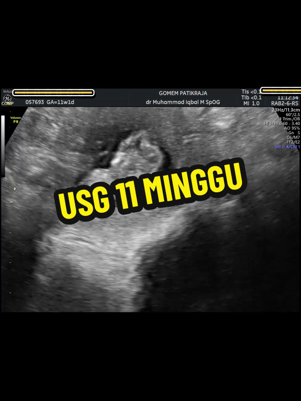 @USG 4D PURWOKERTO