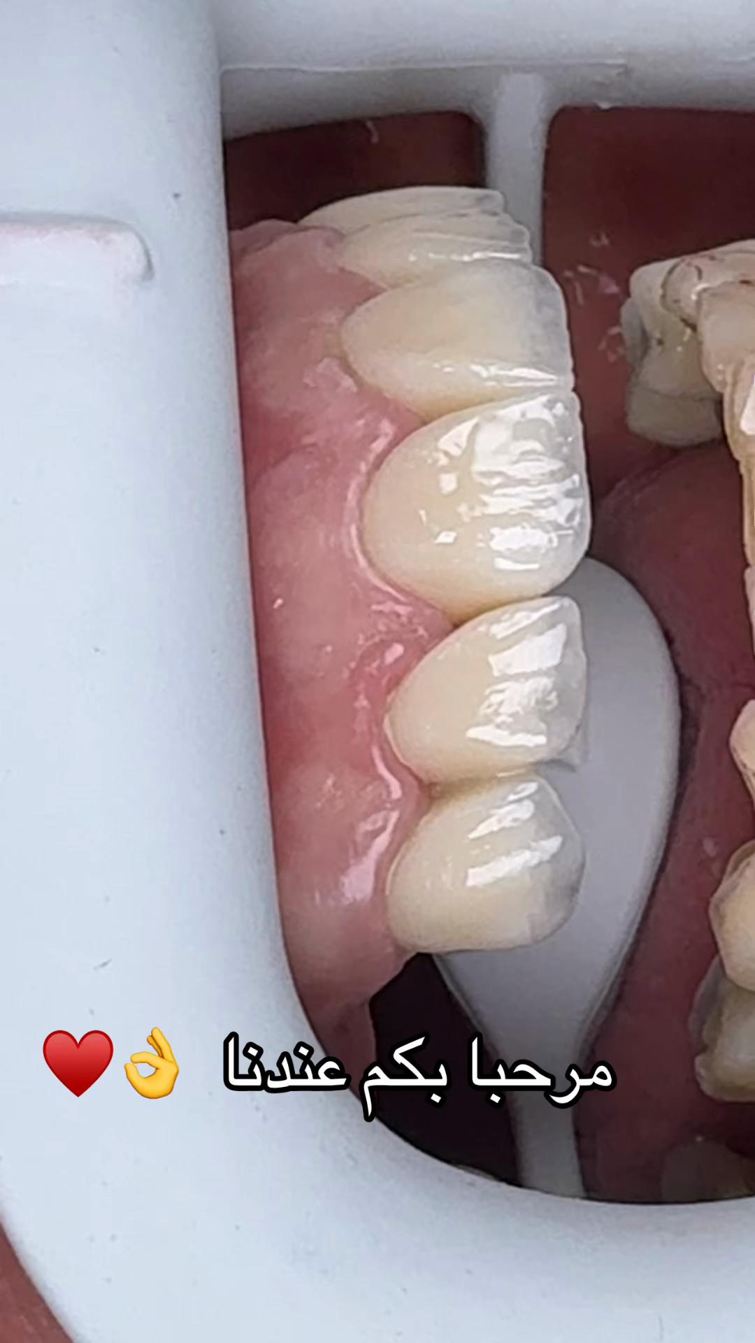 @GOSMILE ROUIBA🇩🇿