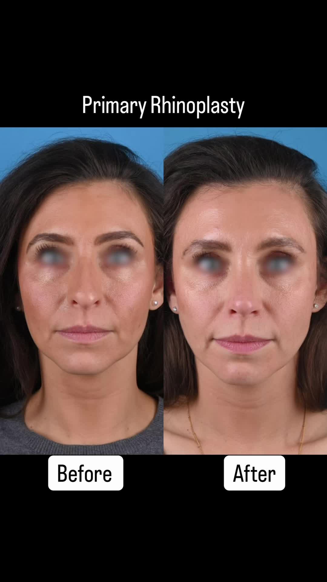 @Dr. Parit Patel, MD