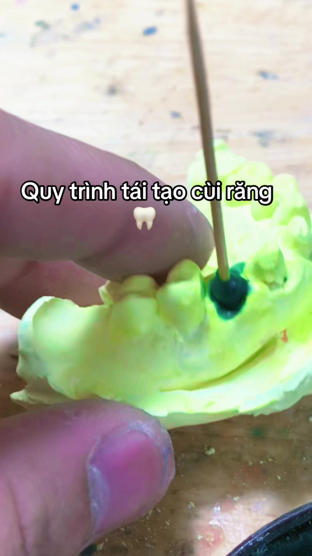 @H&ugrave;ng răng sứ 🦷🦷