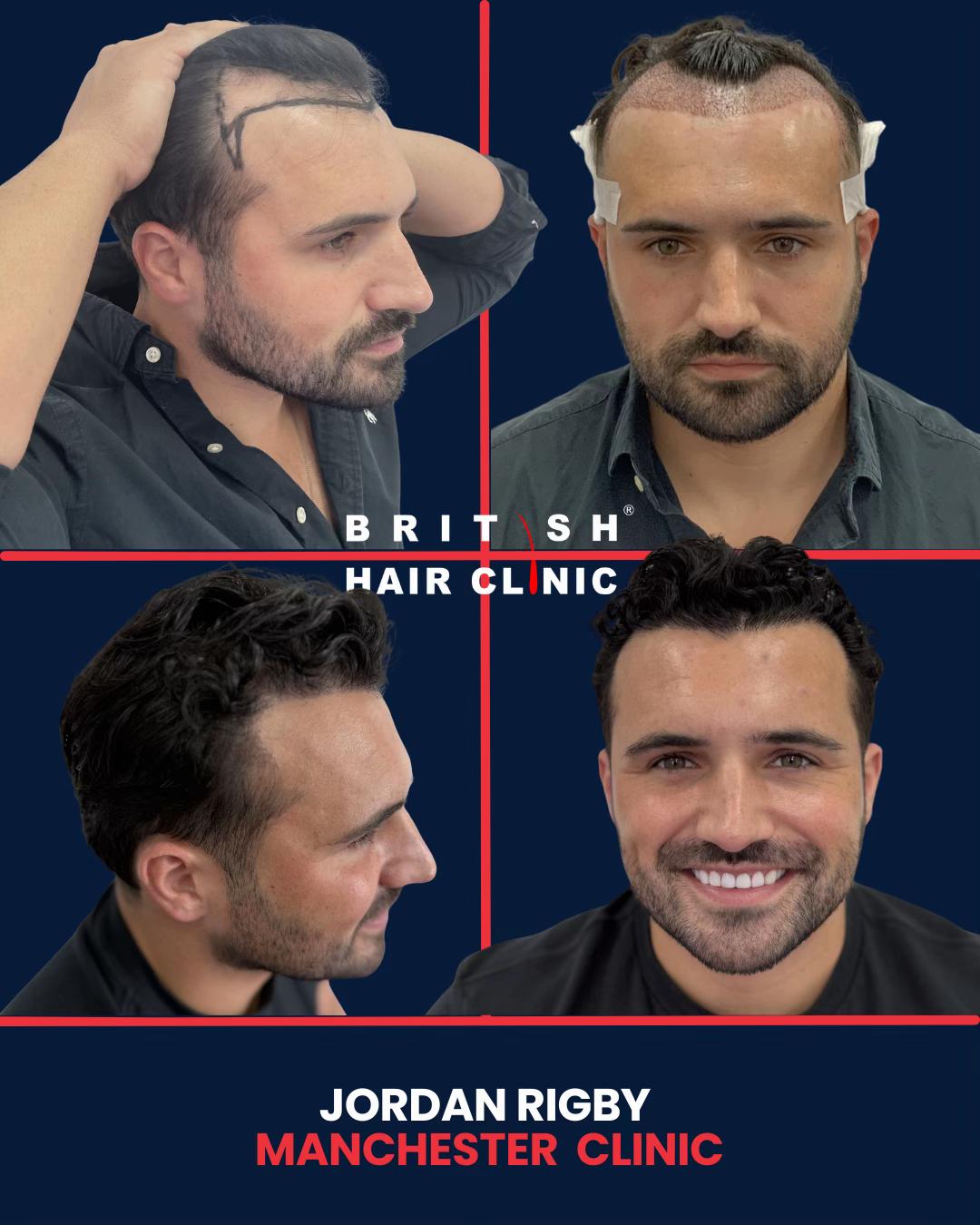 @British Hair Clinic