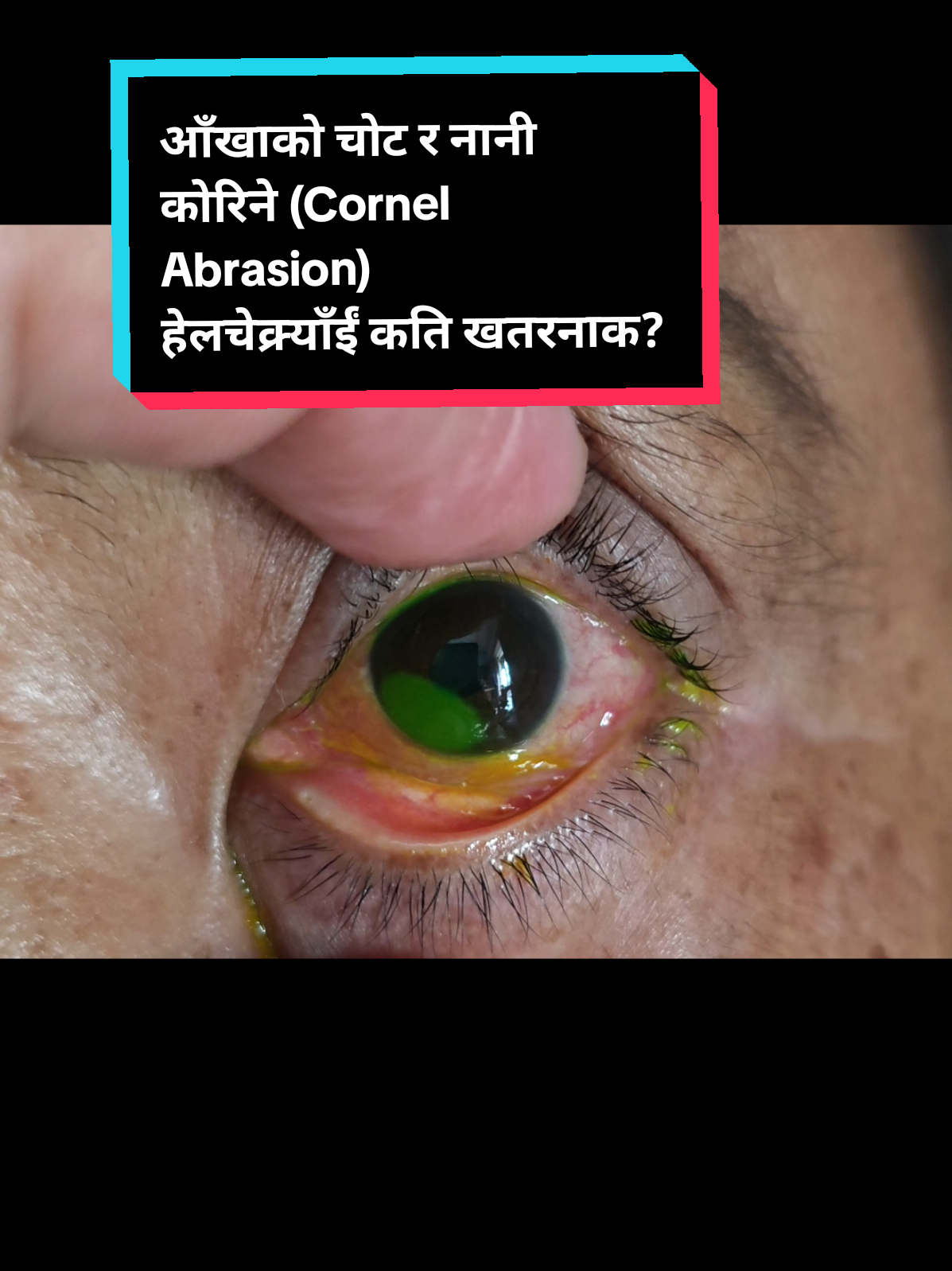 @Amit Kc-OD  👀😍🙏🇳🇵