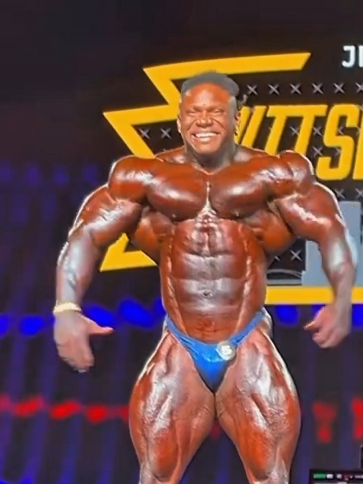 @Fernando Arroyo