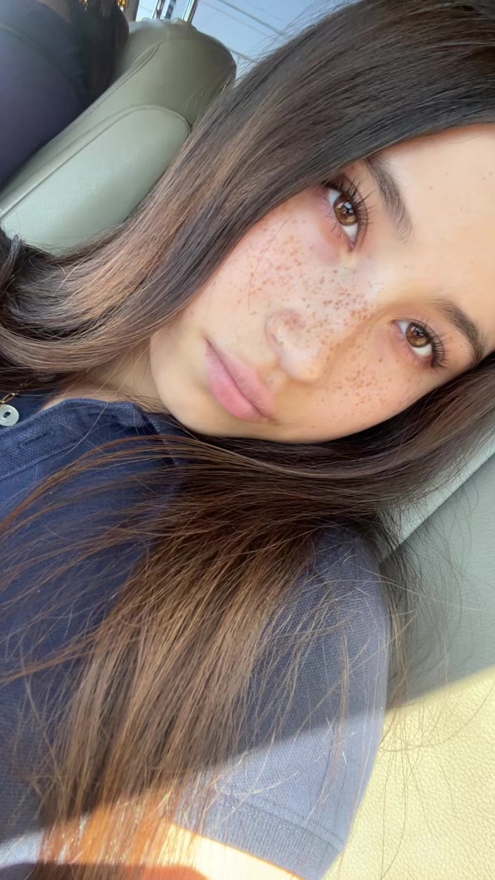 @freckleface2222