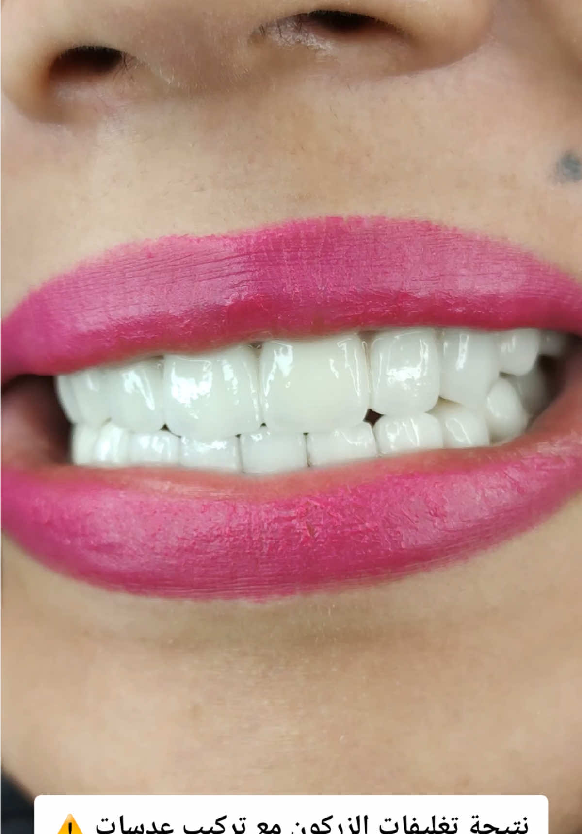 @brightsmileee1