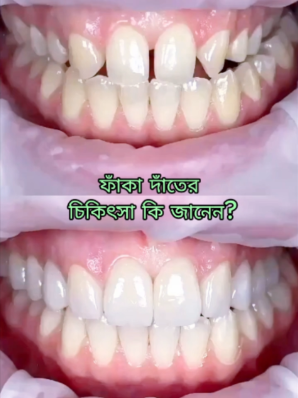 @Tech Dental