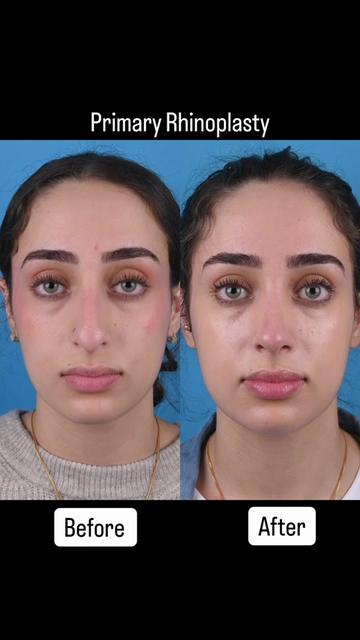 @Dr. Parit Patel, MD