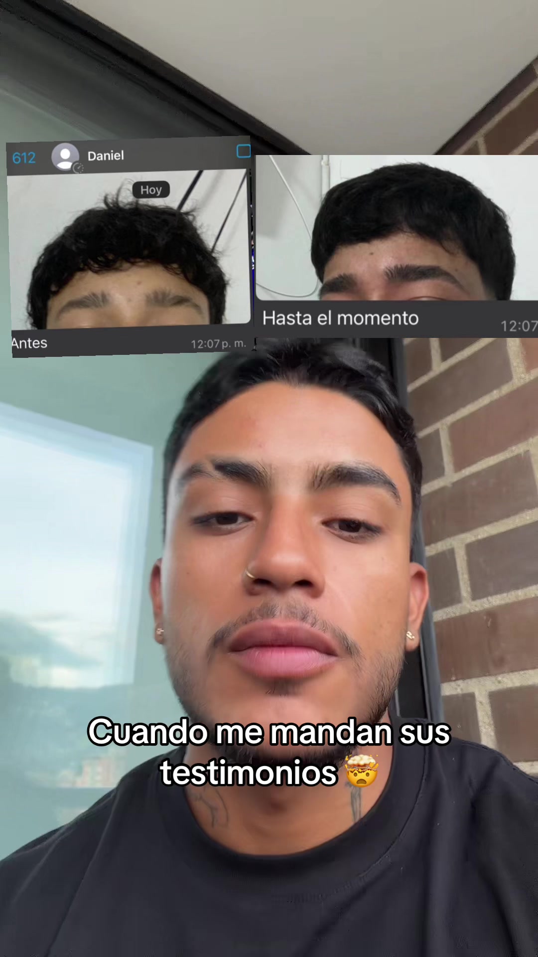 @cano.minoxidil