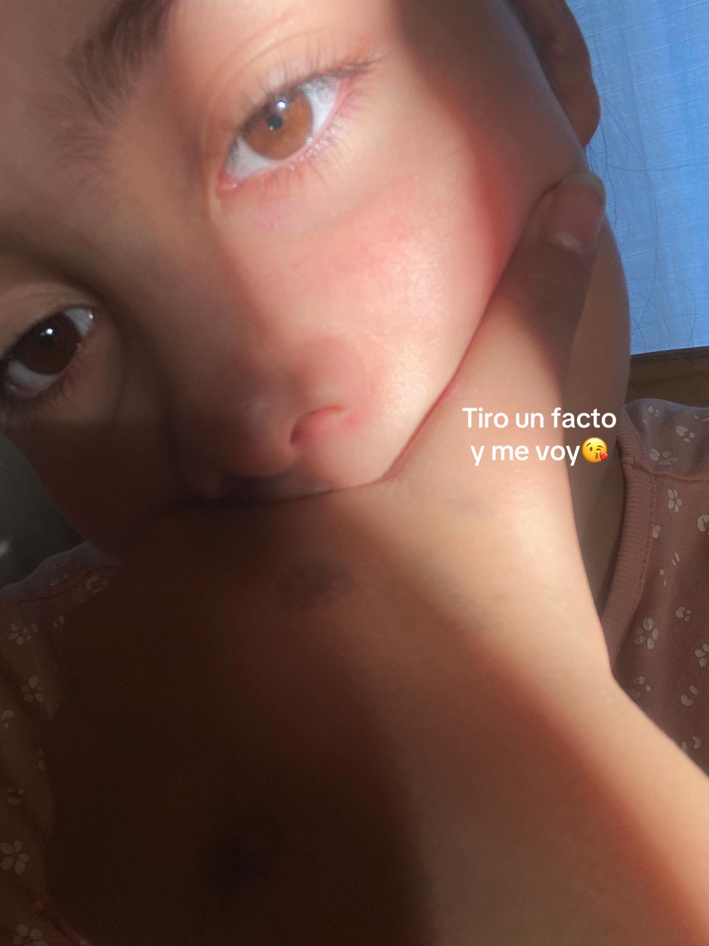 @Renuu💗