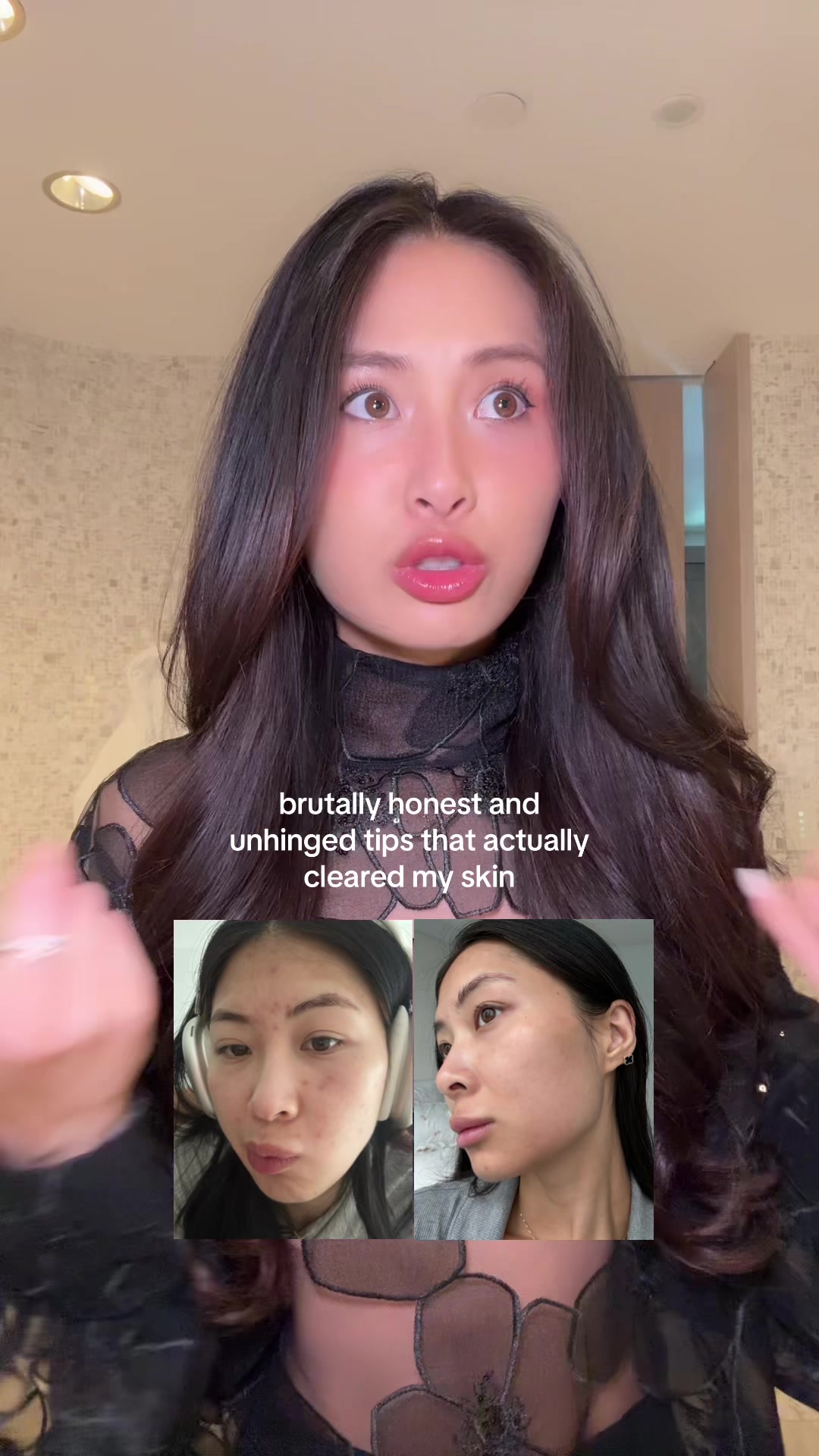 @kaila