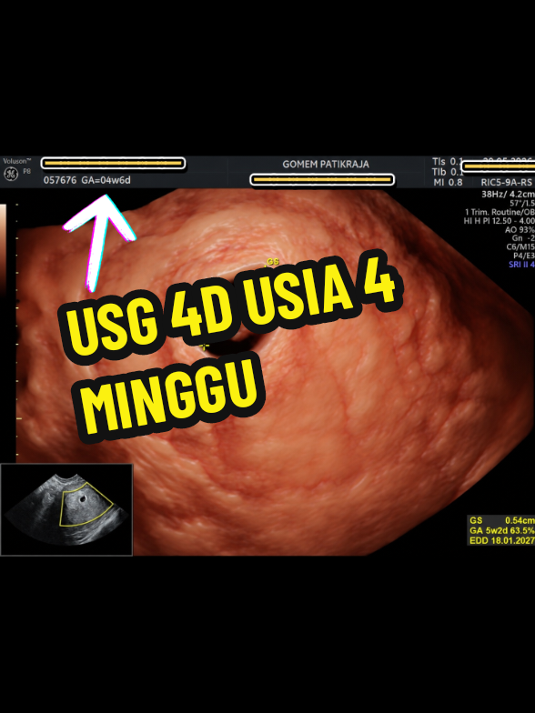@USG 4D PURWOKERTO