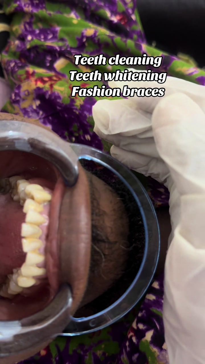 @Teethwhitening