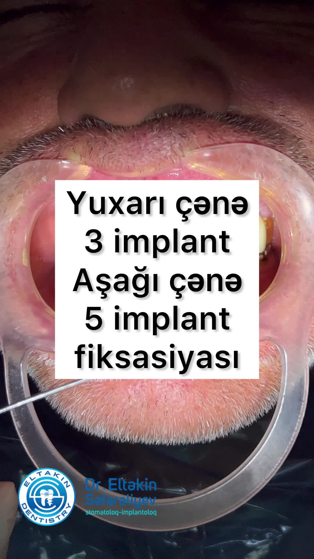 @eltakindentistry