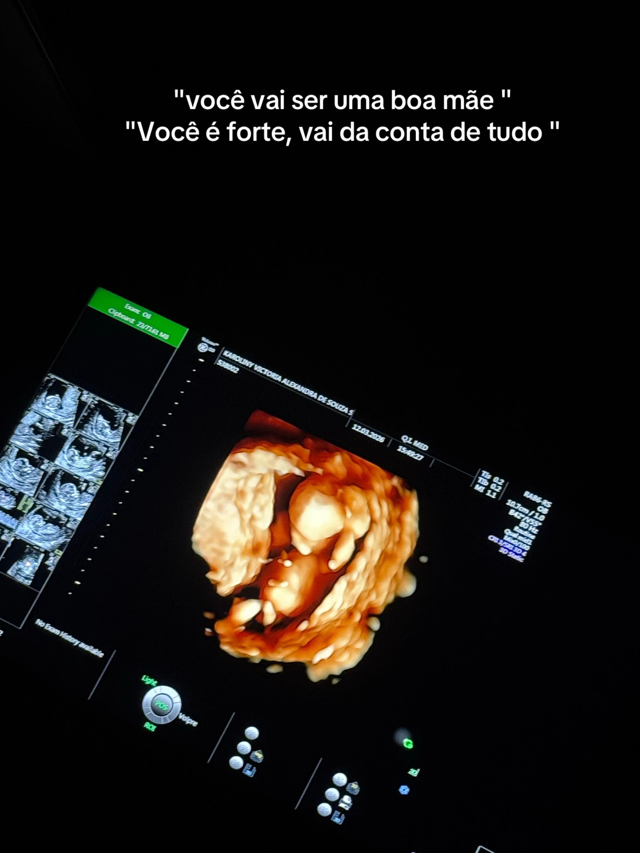 @karolvgomes