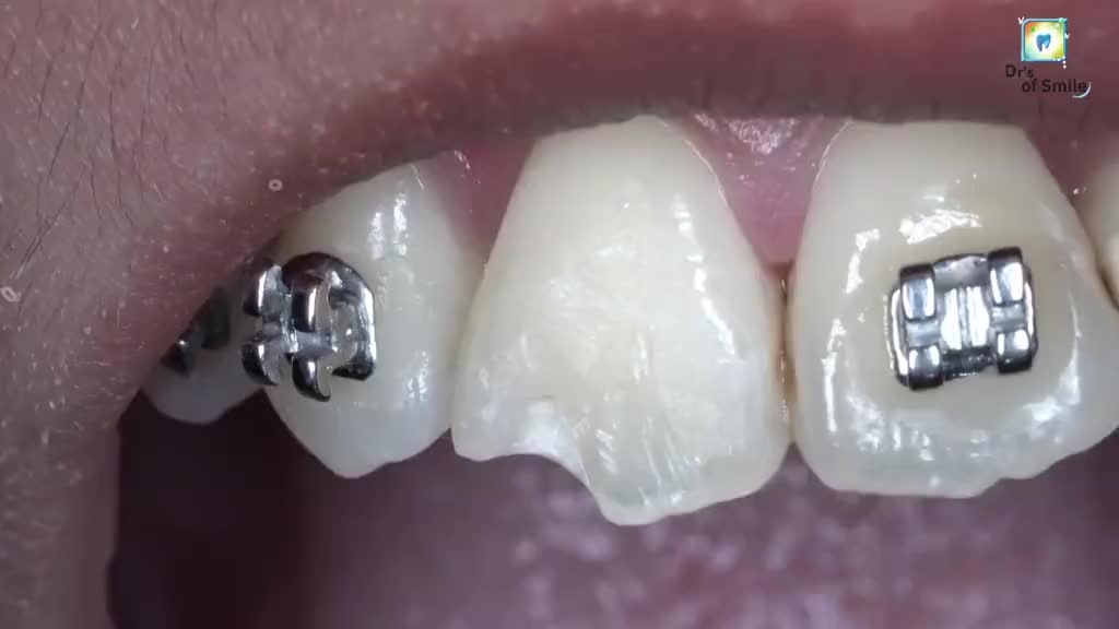 @𝗗𝗿'𝘀 𝗢𝗳 𝗦𝗺𝗶𝗹𝗲🦷🧑‍⚕️