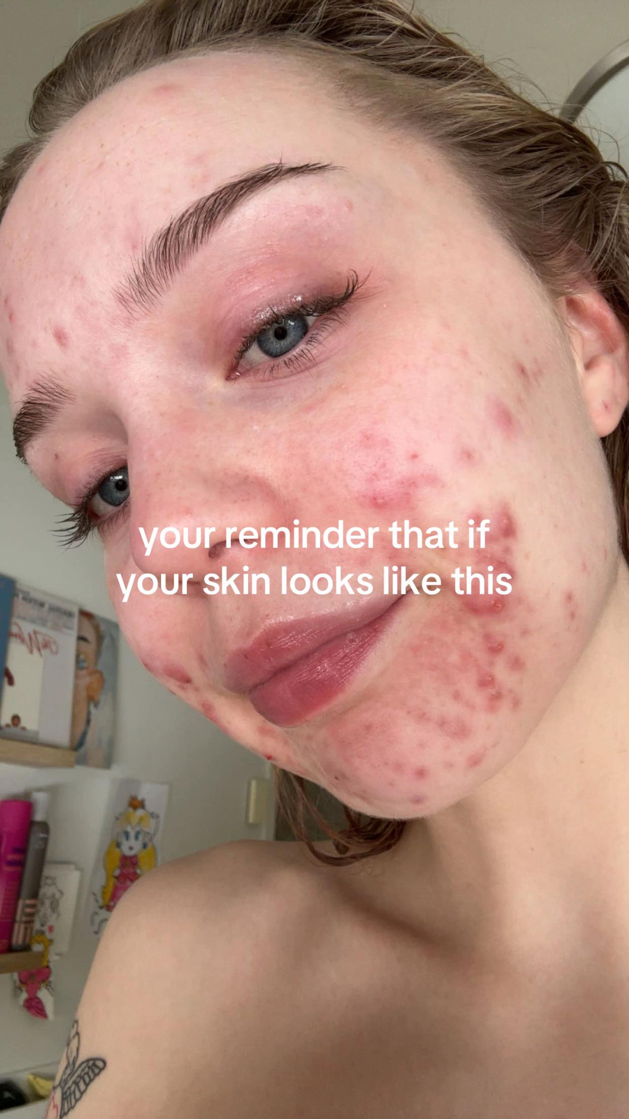 @ragnhild willa$$en