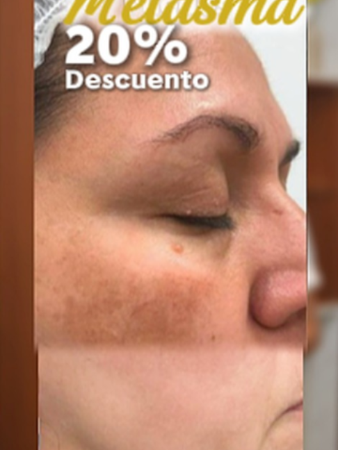 @RebellSpa