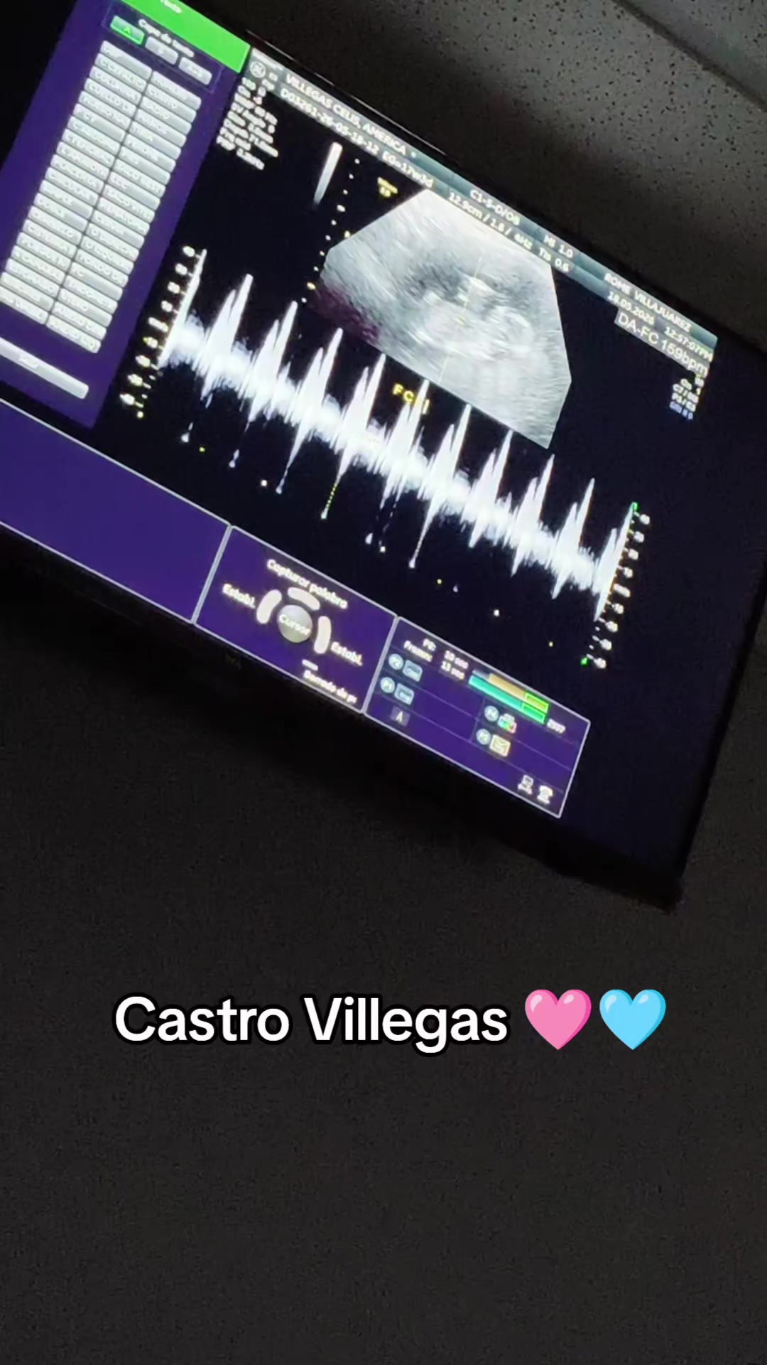 @Ameriica Viillegas