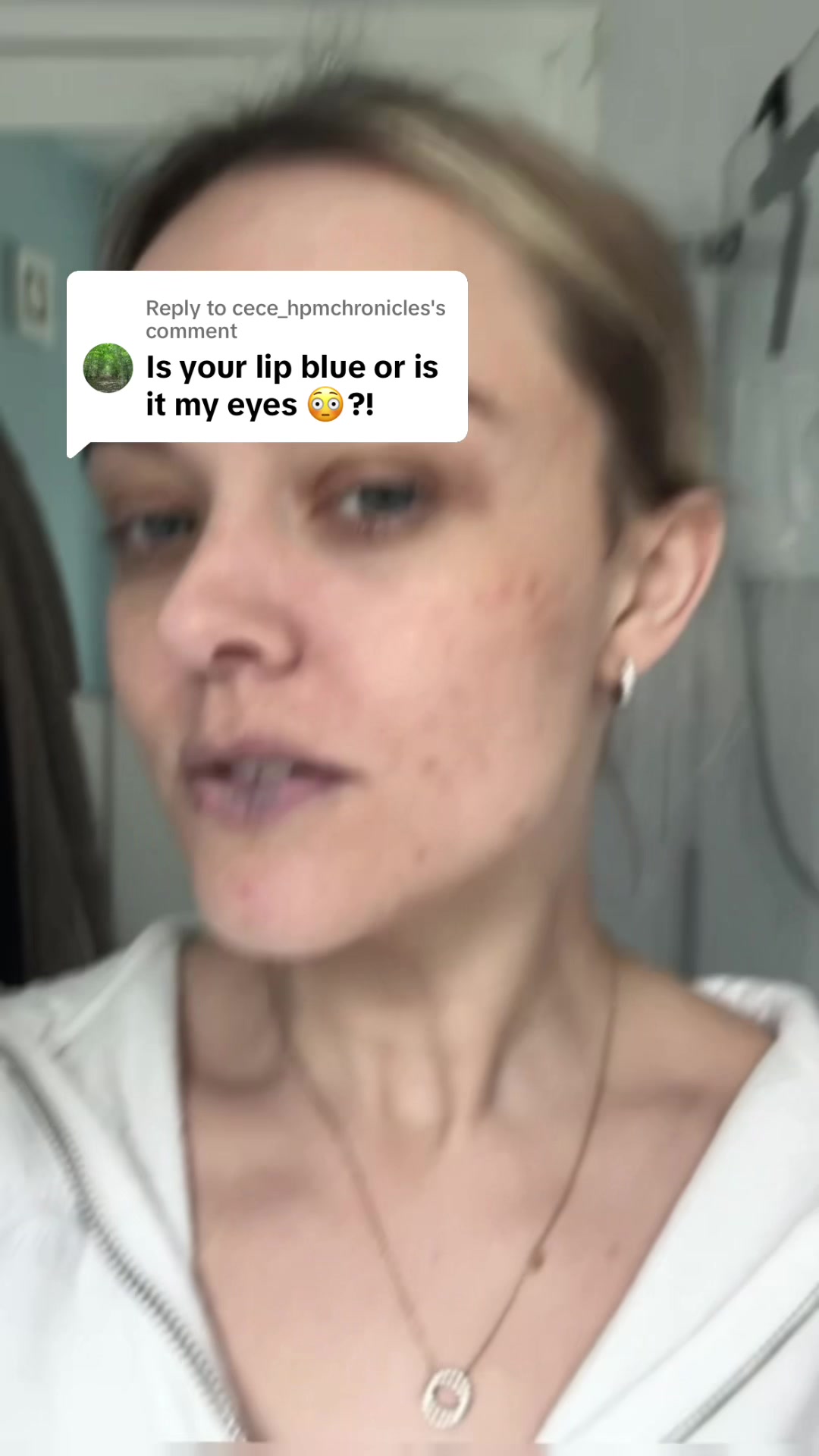 @Soph | IBD | POTS | EDS🦓🤍