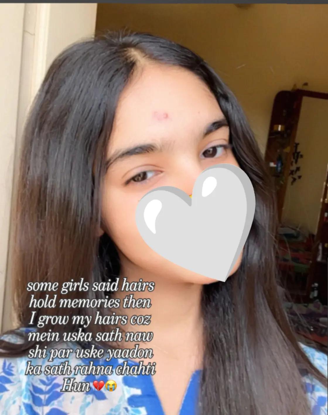 @<s🫠T>