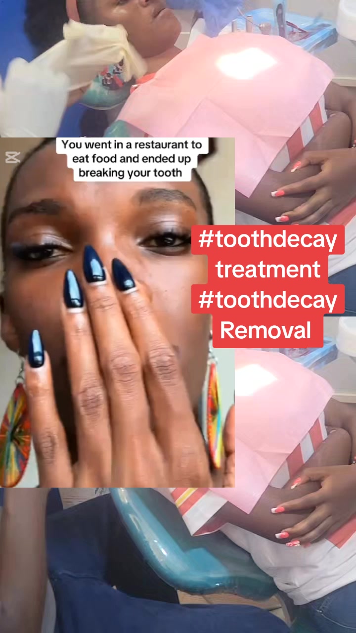 @Allianz Dental studio🦷🦷🇺🇬
