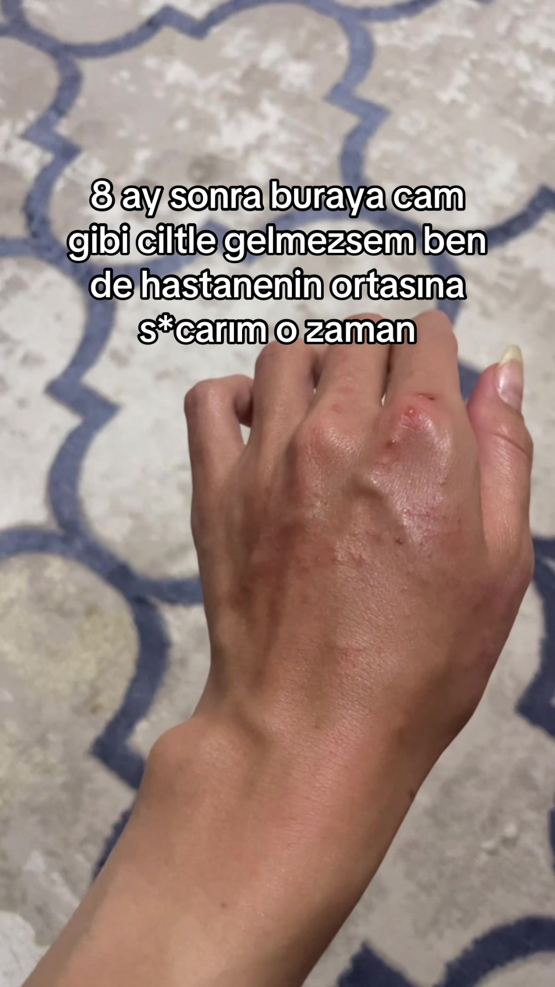 @theAyşe