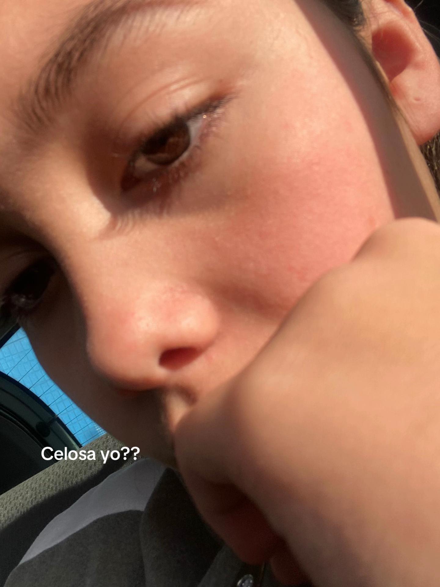 @Renuu💗