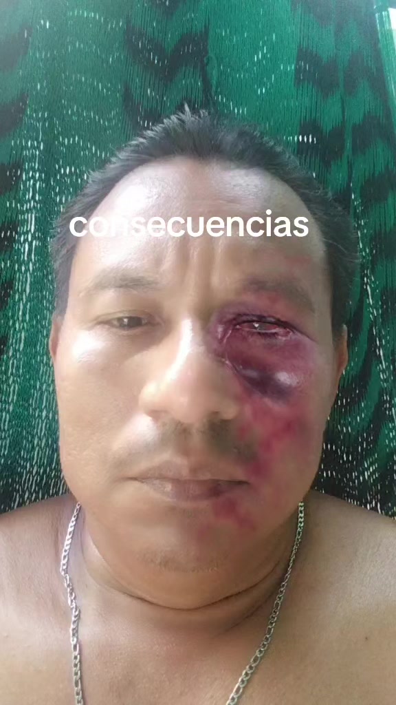 @Jose Manuel Ortiz Ce