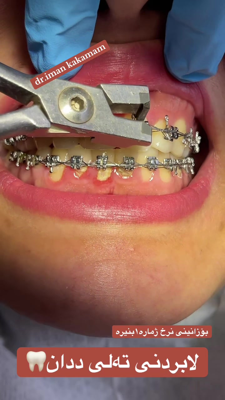 @🦷 دکتۆرە ئیمان کاکەمەم