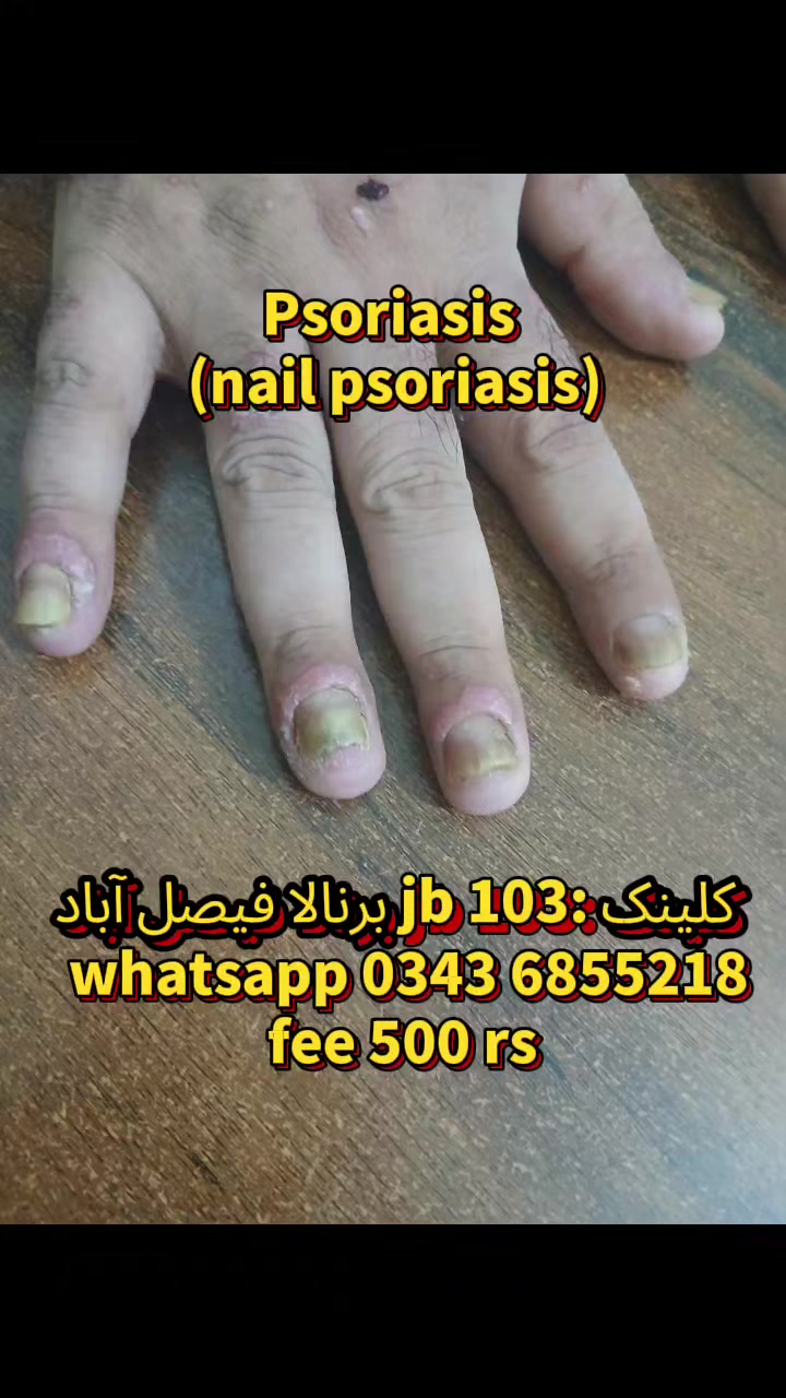 @MN HAIR AND SKIN CARE