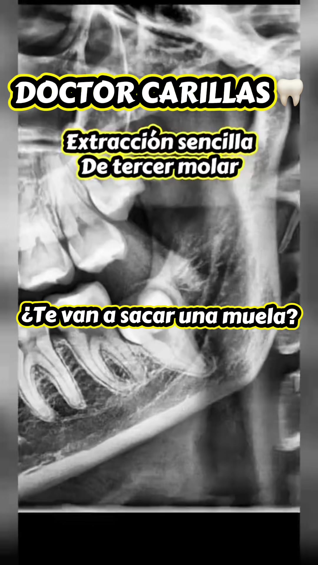 @Dr Carillas