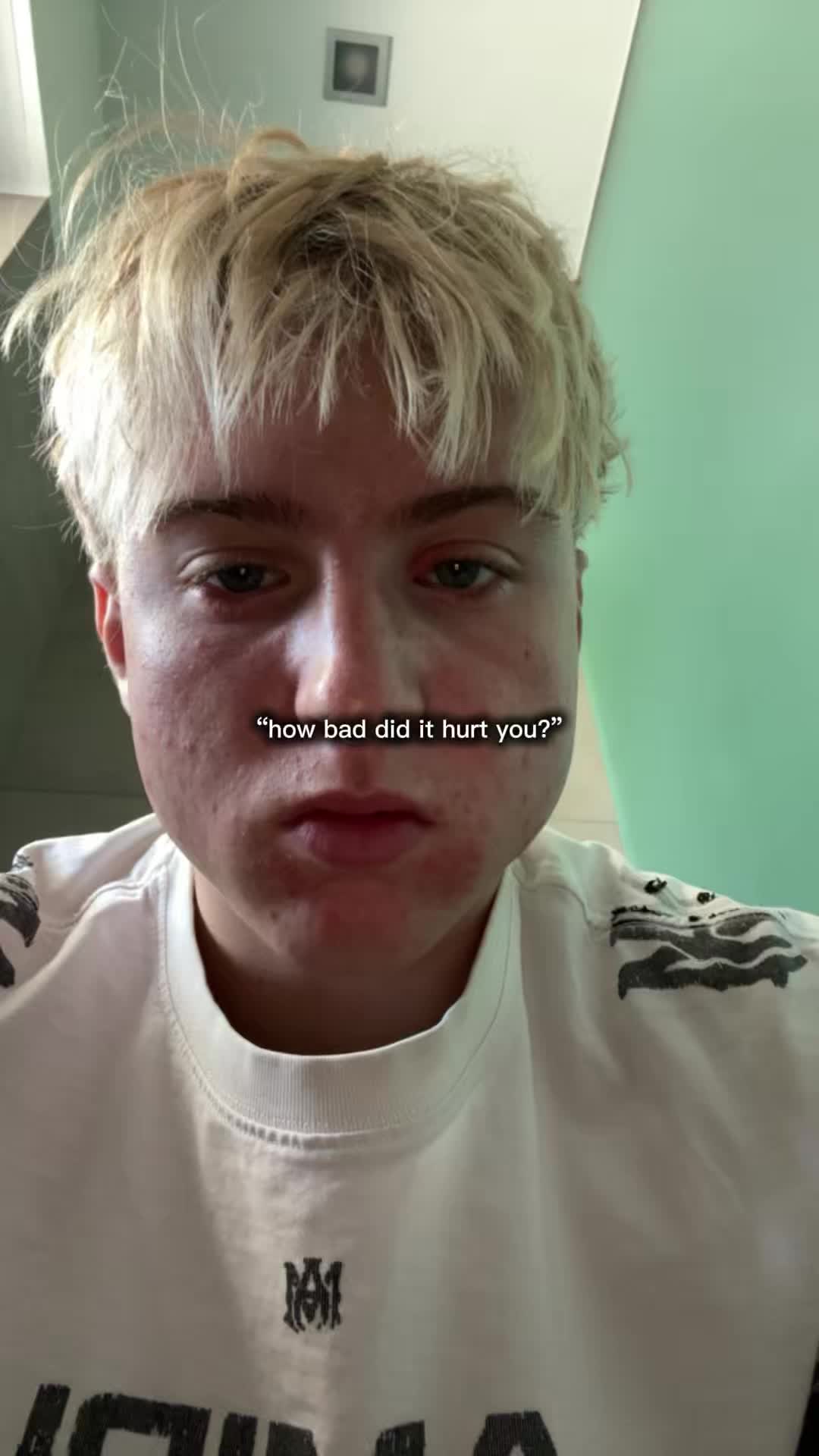 @Tilllll