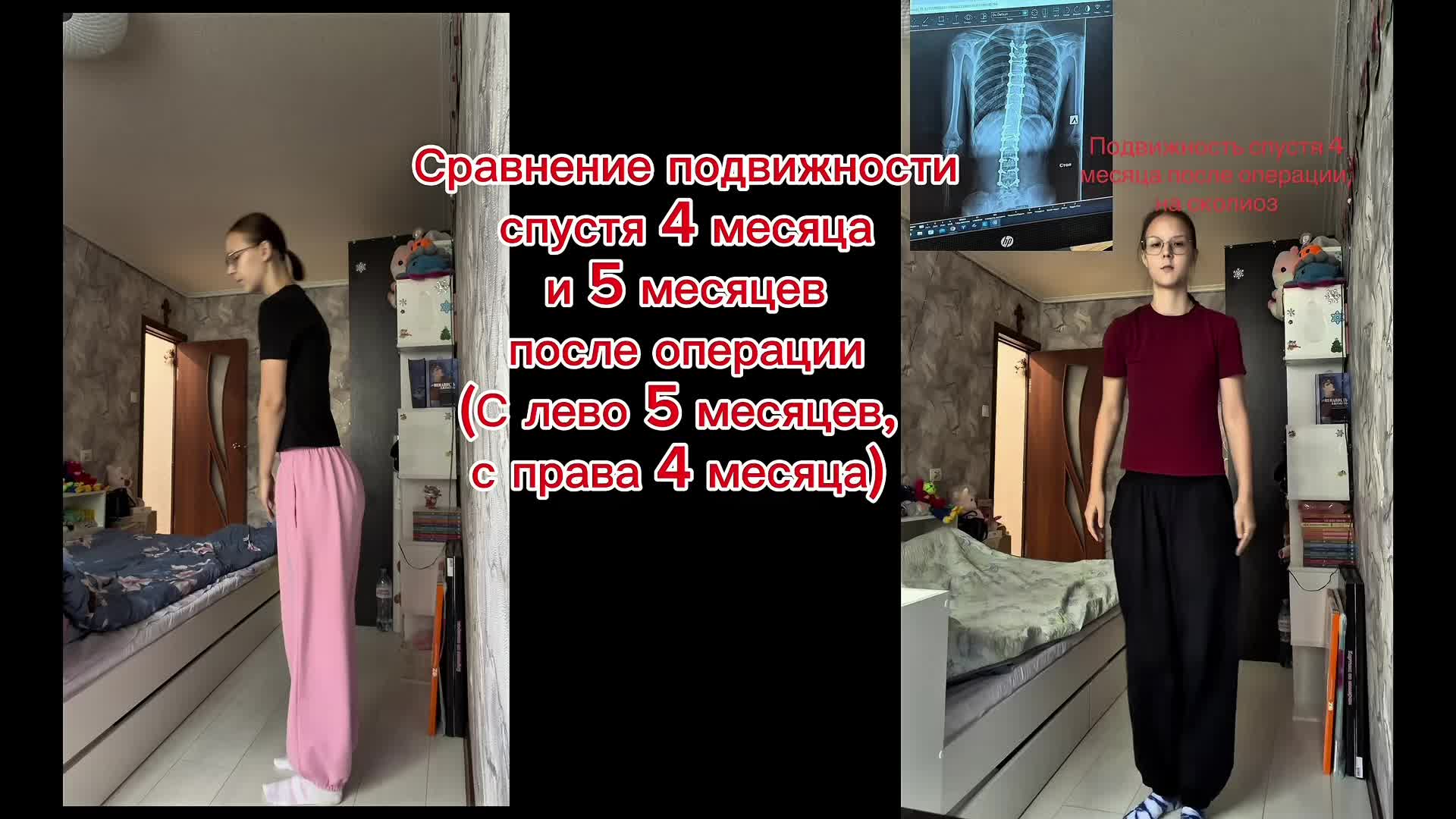 @Титановая леди